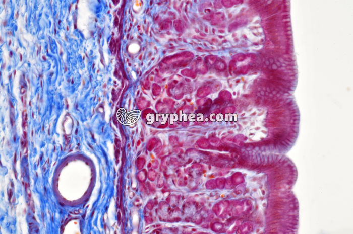 Estomac pylorique x100 - gryphea.org